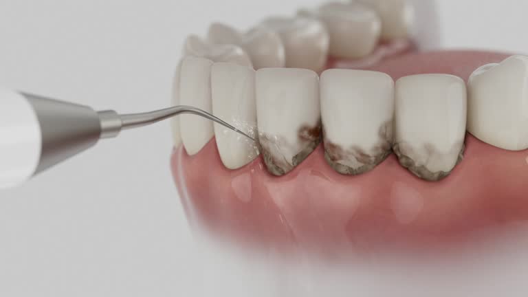 Reliable Dental contractor in River Ridge, FL by Smile Center Dentistry